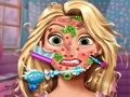 Igra Zdravnik za kožo Goldie Princess spletu