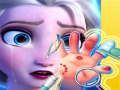 Igra Elsa Hand Doctor spletu