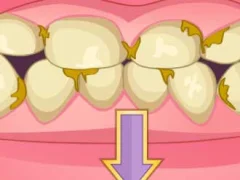 Igra Bad Teeth Makeover spletu