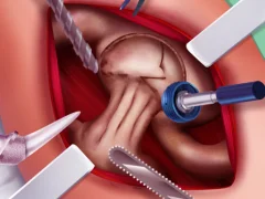 Igra Princess Hips Surgery spletu