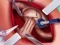 Igra Princess Hips Surgery spletu