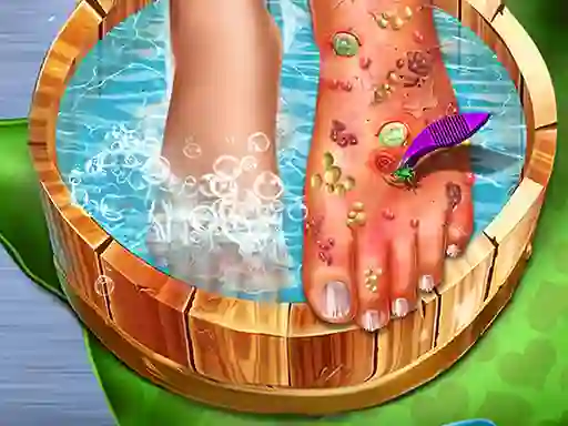 Igra Feet Skin Doctor spletu