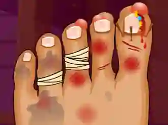 Igra Monster Foot Doctor spletu