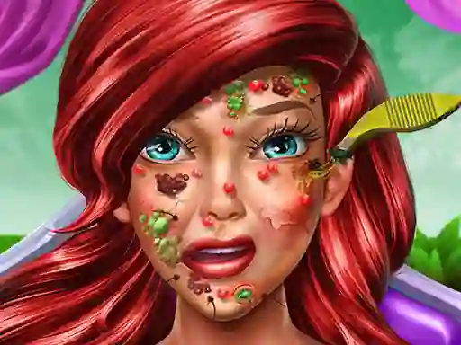Igra Princess Mermaid Skin Doctor spletu