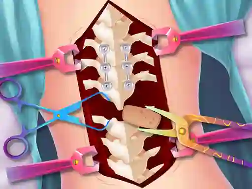 Igra Anna Scoliosis Surgery spletu