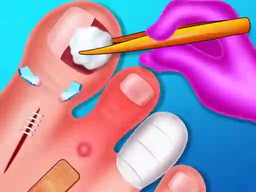Igra Funny Nail Doctor spletu